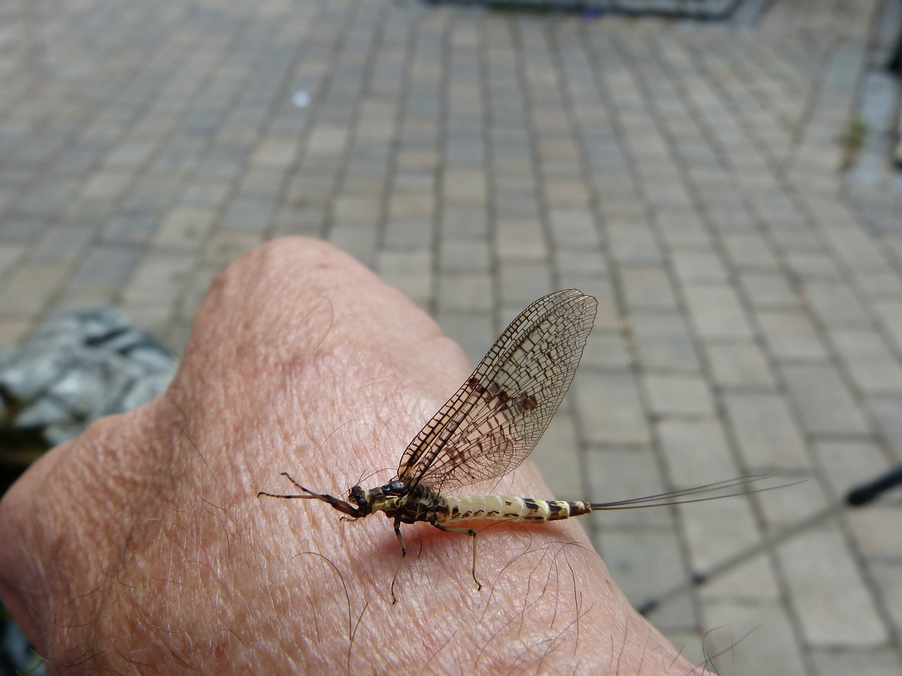 복부 지방분해주사